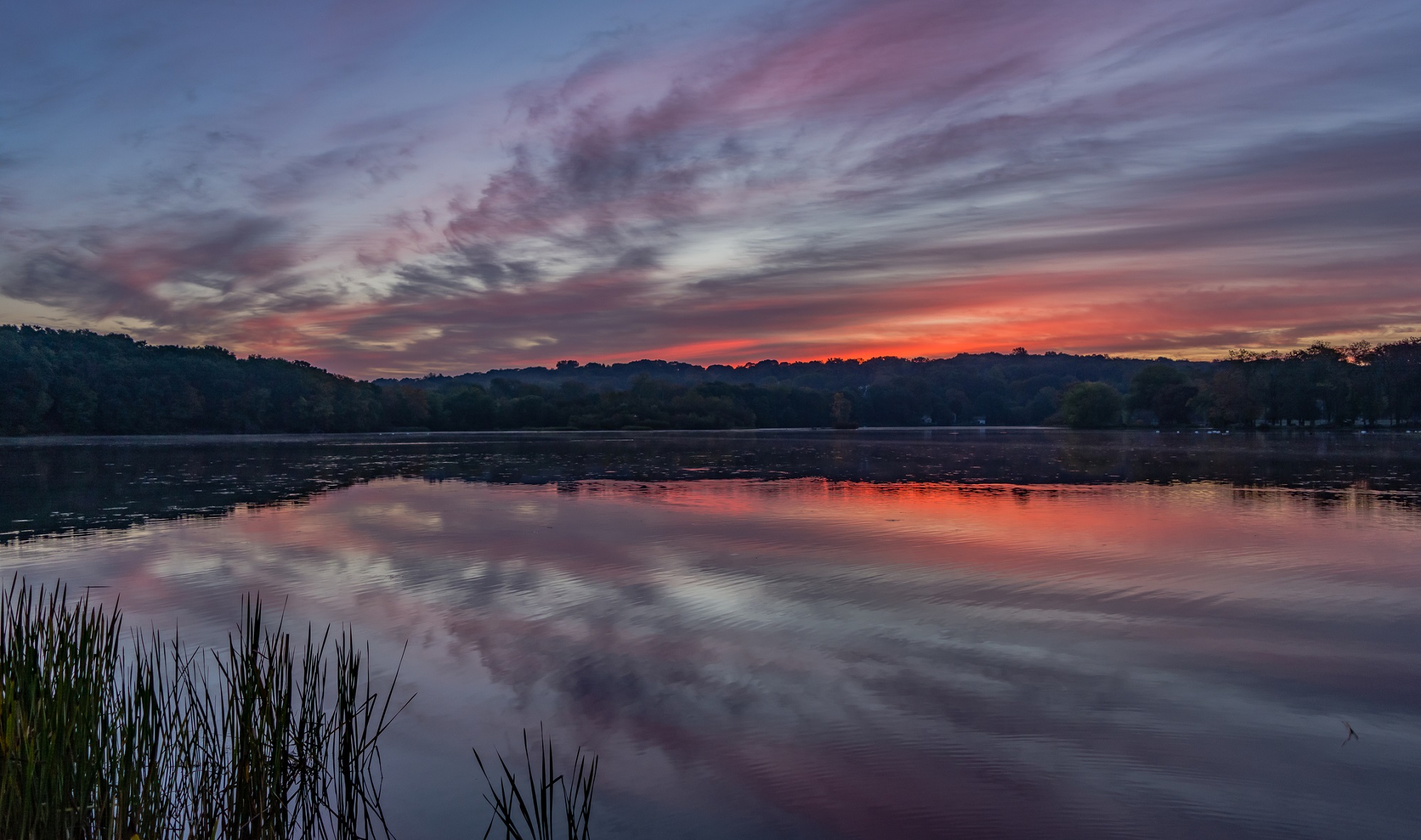 Endodontics Wallingford CT, Endodontist